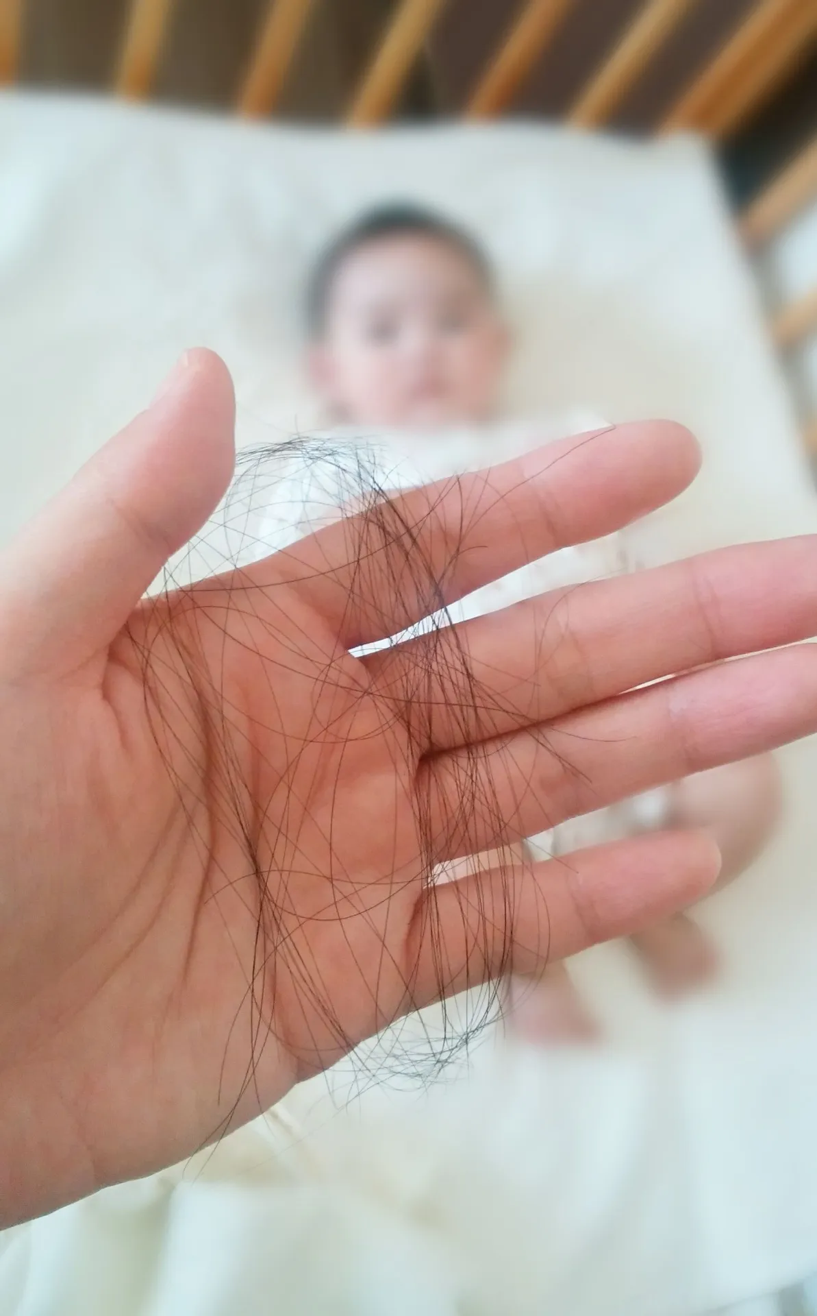 浅草駅近くで実践する産後の抜け毛ケアと頭皮鍼の効果