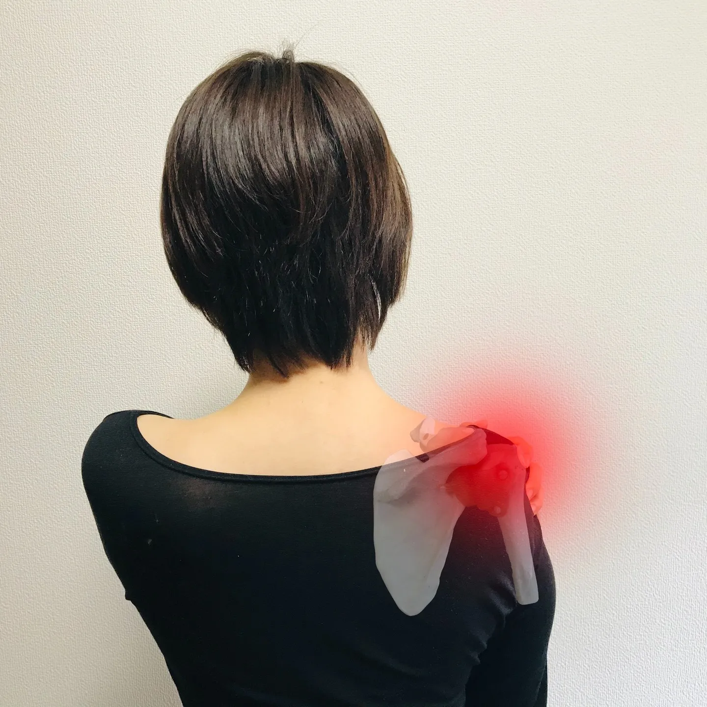 五十肩で動かせない痛みを鍼灸と整体で根本改善できる最新対策を詳しく解説